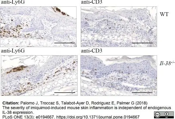 Anti Human CD3 Antibody, clone CD3-12 (Monoclonal Antibody Antibody) gallery image 10