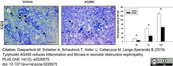 Anti Human CD3 Antibody, clone CD3-12 (Monoclonal Antibody Antibody) gallery image 13