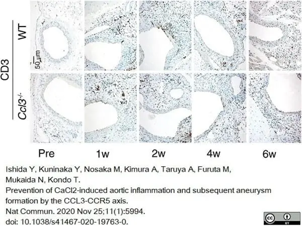 Anti Human CD3 Antibody, clone CD3-12 (Monoclonal Antibody Antibody) gallery image 16