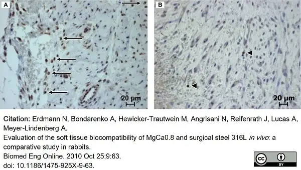 Anti Human CD3 Antibody, clone CD3-12 (Monoclonal Antibody Antibody) gallery image 19