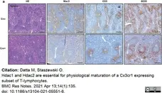 Anti Human CD3 Antibody, clone CD3-12 (Monoclonal Antibody Antibody) gallery image 21