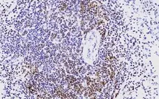 Anti Human CD3 Antibody, clone CD3-12 (Monoclonal Antibody Antibody) gallery image 23