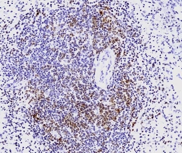 Anti Human CD3 Antibody, clone CD3-12 (Monoclonal Antibody Antibody) gallery image 23