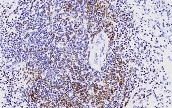 Anti Human CD3 Antibody, clone CD3-12 (Monoclonal Antibody Antibody) gallery image 23