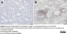 Anti Human CD3 Antibody, clone CD3-12 (Monoclonal Antibody Antibody) gallery image 24