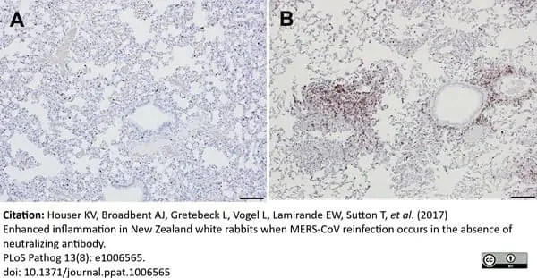 Anti Human CD3 Antibody, clone CD3-12 (Monoclonal Antibody Antibody) gallery image 24