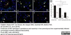 Anti Human CD3 Antibody, clone CD3-12 (Monoclonal Antibody Antibody) gallery image 26