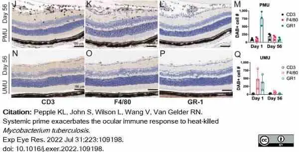 Anti Human CD3 Antibody, clone CD3-12 (Monoclonal Antibody Antibody) gallery image 30