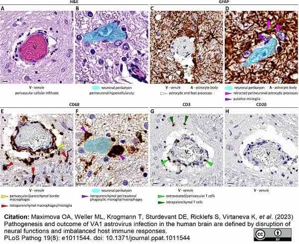 Anti Human CD3 Antibody, clone CD3-12 (Monoclonal Antibody Antibody) gallery image 32