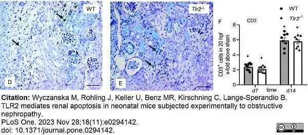 Anti Human CD3 Antibody, clone CD3-12 (Monoclonal Antibody Antibody) gallery image 34