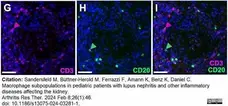 Anti Human CD3 Antibody, clone CD3-12 (Monoclonal Antibody Antibody) gallery image 35
