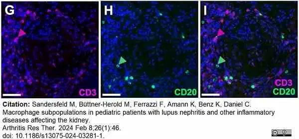 Anti Human CD3 Antibody, clone CD3-12 (Monoclonal Antibody Antibody) gallery image 35