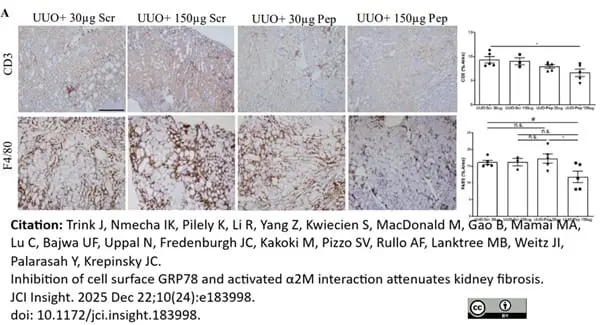 Anti Human CD3 Antibody, clone CD3-12 (Monoclonal Antibody Antibody) gallery image 39