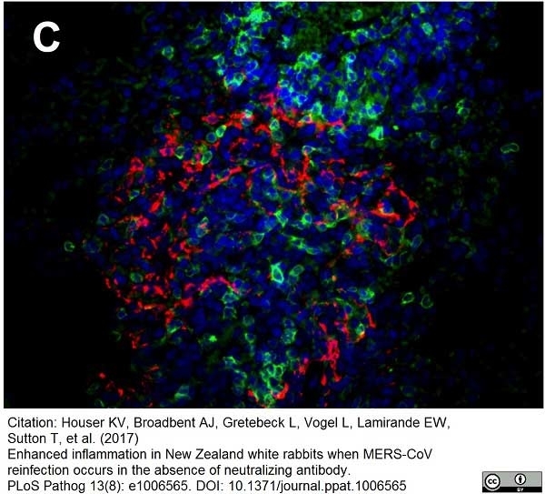 Anti Human CD3 Antibody, clone CD3-12 (Monoclonal Antibody Antibody) gallery image 9