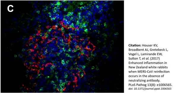 Anti Human CD3 Antibody, clone CD3-12 (Monoclonal Antibody Antibody) gallery image 9