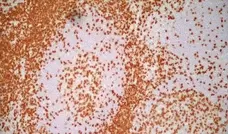 Anti Human CD3 Antibody, clone UCHT1 gallery image 7