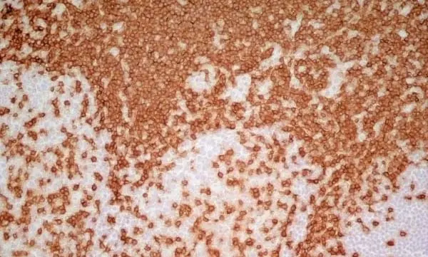 Anti Human CD3 Antibody, clone UCHT1 gallery image 8
