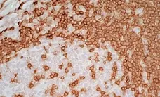 Anti Human CD3 Antibody, clone UCHT1 gallery image 9
