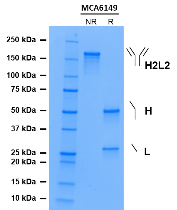Anti CD30 (Brentuximab Biosimilar) Antibody, clone cAC10 gallery image 1