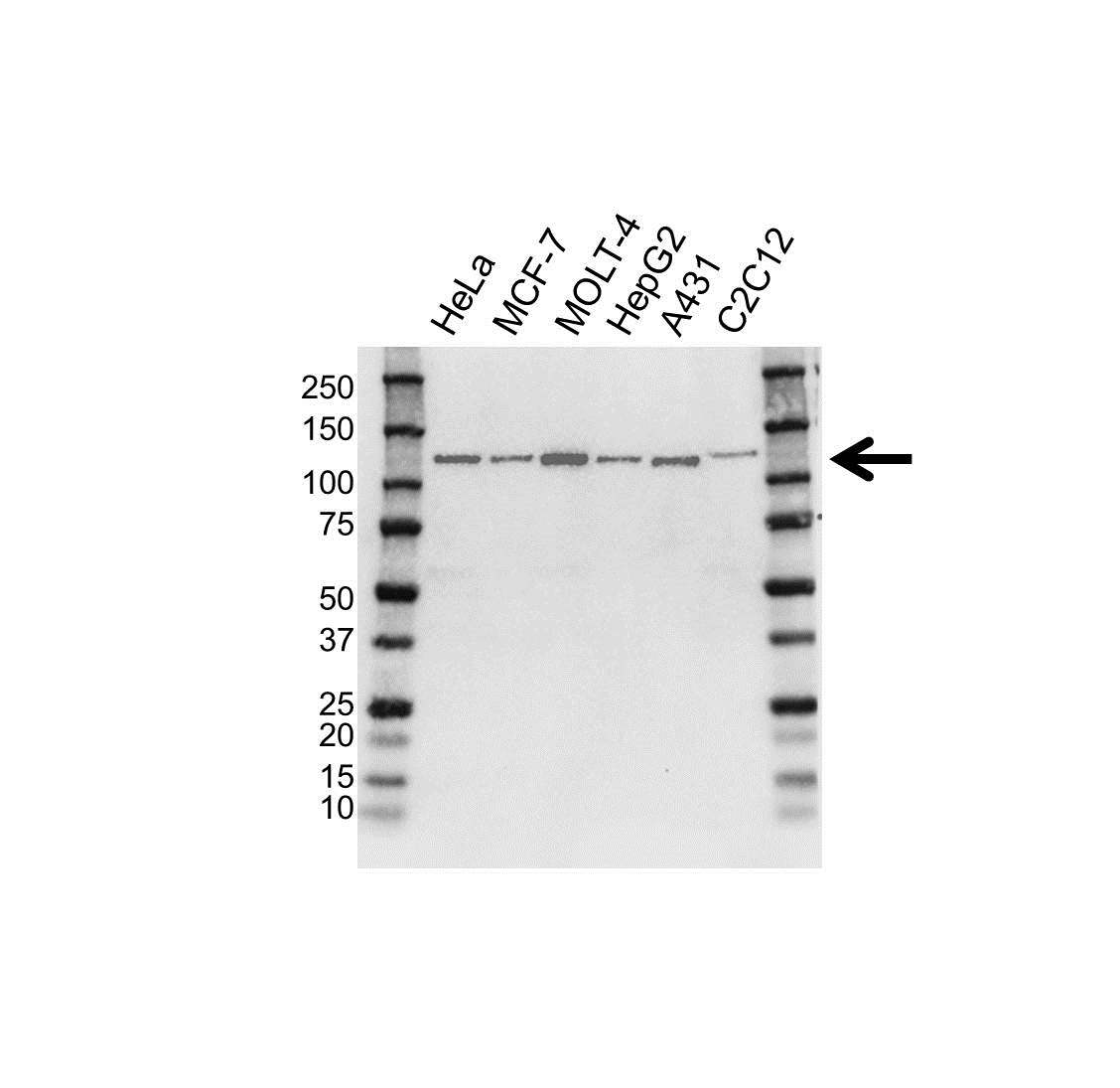 Anti CD30 Antibody, clone OTI3B10 (PrecisionAb Monoclonal Antibody) gallery image 1