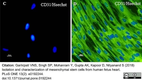 Anti Human CD31 Antibody, clone WM59 gallery image 22