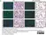 Anti Human CD31 Antibody, clone WM59 thumbnail image 8