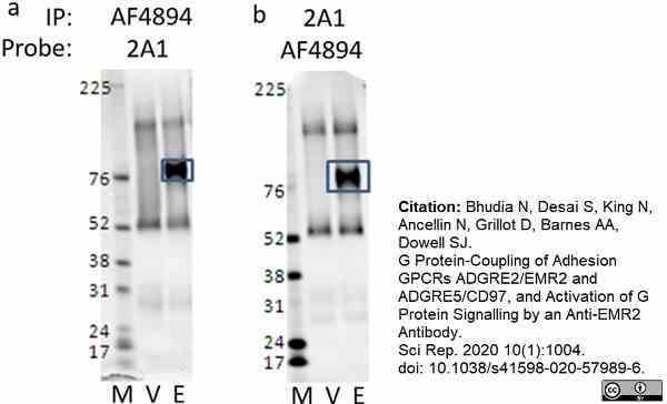 Anti Human CD312 Antibody, clone 2A1 gallery image 11