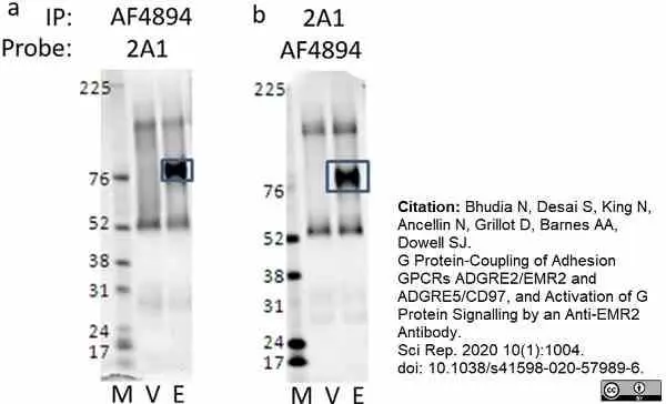 Anti Human CD312 Antibody, clone 2A1 gallery image 11