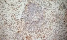 Anti Human CD314 Antibody, clone 1D11 gallery image 1