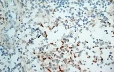 Anti Human CD314 Antibody, clone 1D11 gallery image 2