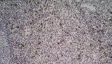 Anti Human CD314 Antibody, clone 1D11 gallery image 4