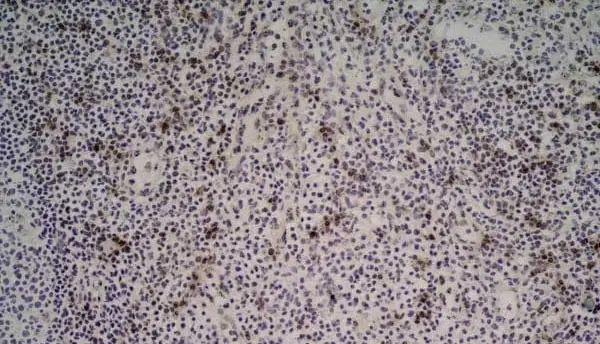 Anti Human CD314 Antibody, clone 1D11 gallery image 4