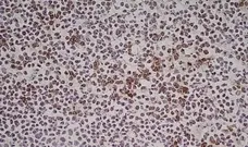 Anti Human CD314 Antibody, clone 1D11 gallery image 5