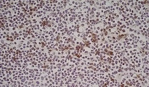 Anti Human CD314 Antibody, clone 1D11 gallery image 5