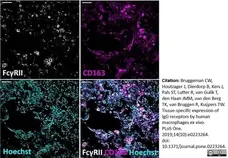 Anti Human CD32 Antibody, clone AT10 gallery image 5
