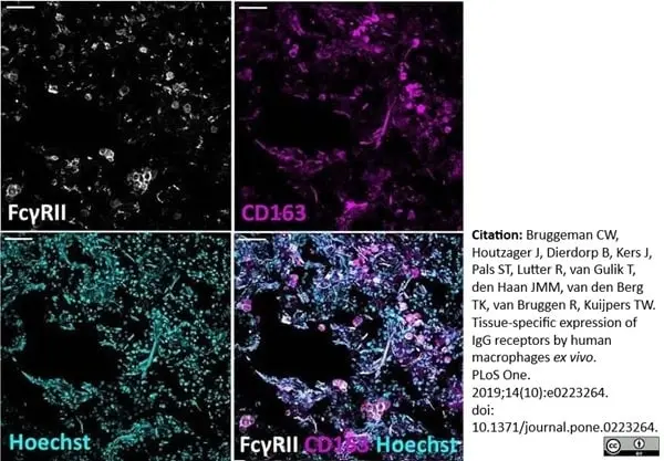 Anti Human CD32 Antibody, clone AT10 gallery image 5