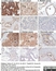 Anti Human CD326 Antibody, clone MOC-31 thumbnail image 11