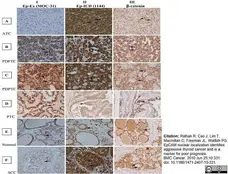 Anti Human CD326 Antibody, clone MOC-31 gallery image 2