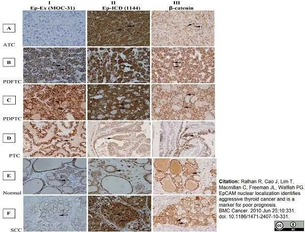 Anti Human CD326 Antibody, clone MOC-31 gallery image 2