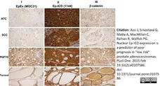 Anti Human CD326 Antibody, clone MOC-31 gallery image 3