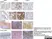 Anti Human CD326 Antibody, clone MOC-31 thumbnail image 4