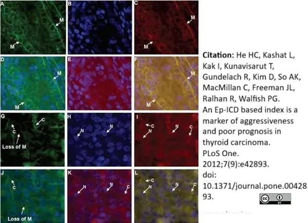 Anti Human CD326 Antibody, clone MOC-31 gallery image 8