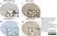 Anti Human CD34 Antibody, clone QBEND/10 thumbnail image 6