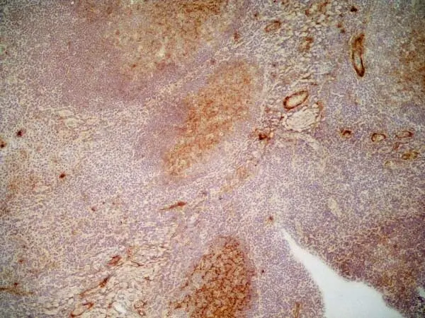 Anti Human CD36 Antibody, clone SMØ gallery image 2