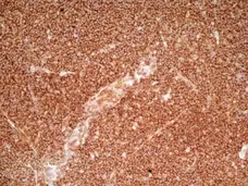 Anti Human CD36 Antibody, clone SMØ gallery image 3