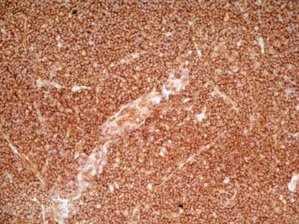 Anti Human CD36 Antibody, clone SMØ gallery image 3