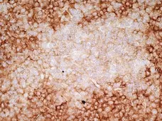 Anti Human CD36 Antibody, clone SMØ gallery image 4