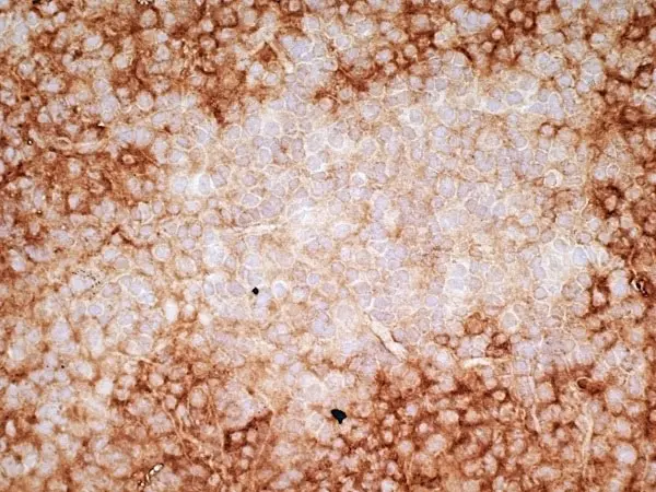 Anti Human CD36 Antibody, clone SMØ gallery image 4