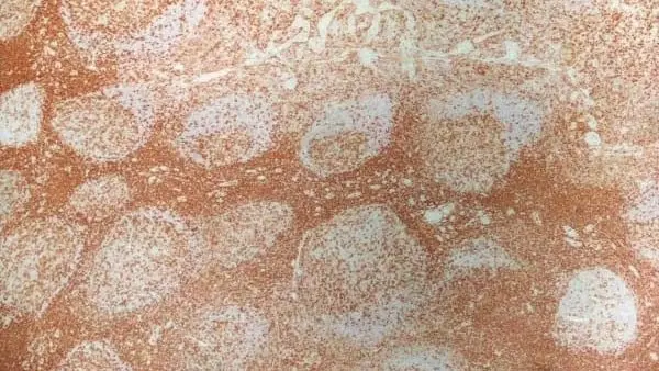 Anti Human CD4 Antibody, clone RPA-T4 gallery image 8