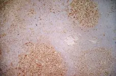 Anti Human CD40 Antibody, clone LOB7/6 gallery image 2